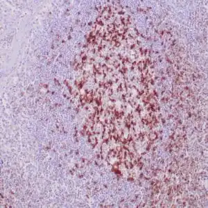 Immunohistochemistry (IHC) : Formalin-fixed, paraffin-embedded human tonsil stained with anti-PD-1 antibody using peroxidase-conjugate and DAB chromogen. Note cytoplasmic staining of T-cells