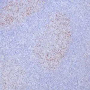 Immunohistochemistry (IHC) : Formalin-fixed, paraffin-embedded human tonsil stained with anti-PD-1 antibody using peroxidase-conjugate and DAB chromogen. Note cytoplasmic staining of germinal center T-cells