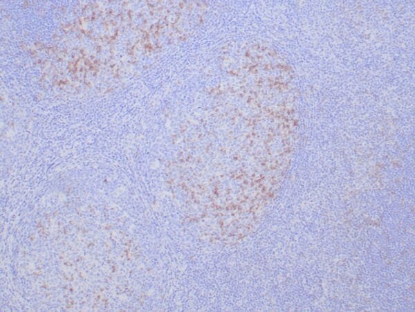 Immunohistochemistry (IHC) : Formalin-fixed, paraffin-embedded human tonsil stained with anti-PD-1 antibody using peroxidase-conjugate and DAB chromogen. Note cytoplasmic staining of germinal center T-cells