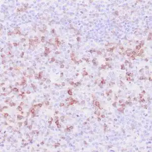 Immunohistochemistry (IHC) : Human spleen stained with anti-Perforin antibody using peroxidase-conjugate and DAB chromogen. Note the cytoplasmic granular staining of cytotoxic T cells.