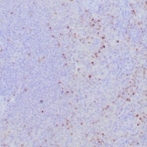 Immunohistochemistry (IHC) : Formalin-fixed, paraffin-embedded human spleen stained with anti-perforin antibody using peroxidase-conjugate and DAB chromogen. Note the cytoplasmic granular staining of cytotoxic T cells