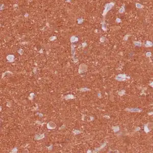 Immunohistochemistry (IHC) : Formalin-fixed and paraffin-embedded human brain stained with anti-PGP 9.5 antibody using peroxidase-conjugate and DAB chromogen. Note the cytoplasmic staining of glial cells