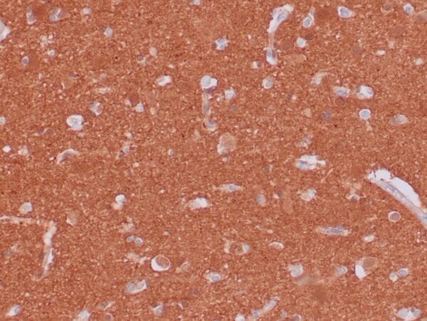 Immunohistochemistry (IHC) : Formalin-fixed and paraffin-embedded human brain stained with anti-PGP 9.5 antibody using peroxidase-conjugate and DAB chromogen. Note the cytoplasmic staining of glial cells