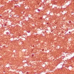 Immunohistochemistry (IHC) : Human cerebellum stained with anti-PGP 9.5 antibody using peroxidase-conjugate and DAB chromogen. Note the cytoplasmic staning of neurons.