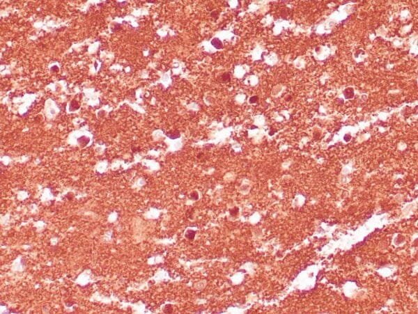 Immunohistochemistry (IHC) : Human cerebellum stained with anti-PGP 9.5 antibody using peroxidase-conjugate and DAB chromogen. Note the cytoplasmic staning of neurons.