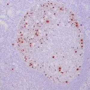 Immunohistochemistry (IHC) : Human tonsil stained with anti-PHH3 antibody using peroxidase-conjugate and DAB chromogen. Note nuclear staining of mitotic lymphocytes.