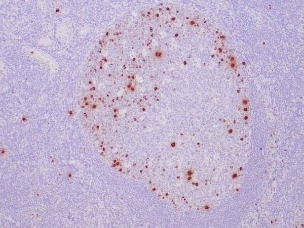 Immunohistochemistry (IHC) : Human tonsil stained with anti-PHH3 antibody using peroxidase-conjugate and DAB chromogen. Note nuclear staining of mitotic lymphocytes.