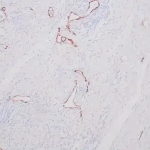 Immunohistochemistry (IHC) : Formalin-fixed, paraffin-embedded human testicle stained with anti-podoplanin antibody using peroxidase-conjugate and DAB chromogen. Note cytoplasmic staining of lymphatic endothelial cells