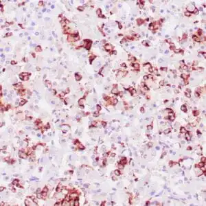 Immunohistochemistry (IHC) : Human pituitary gland stained with anti-Prolactin antibody using peroxidase-conjugate and DAB chromogen. Note cytoplasmic staining of some glandular cells.