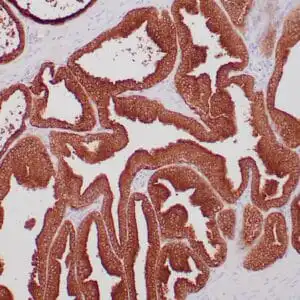 Immunohistochemistry (IHC) : Formalin-fixed, paraffin-embedded human prostate stained with anti-PAS antibody using peroxidase-conjugate and DAB chromogen. Note cytoplasmic staining of glandular cells.