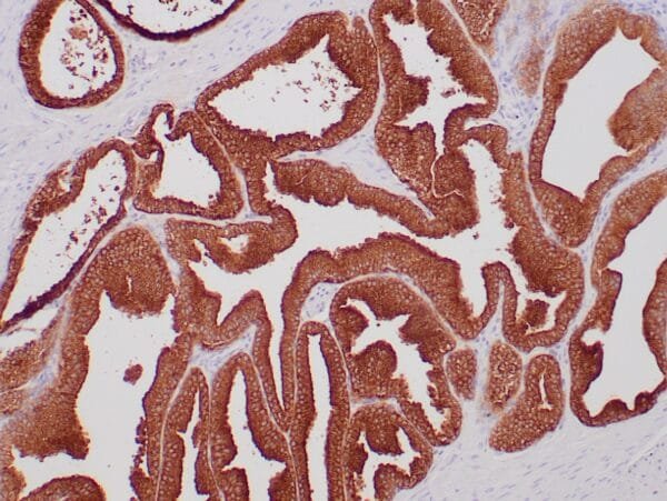 Immunohistochemistry (IHC) : Formalin-fixed, paraffin-embedded human prostate stained with anti-PAS antibody using peroxidase-conjugate and DAB chromogen. Note cytoplasmic staining of glandular cells.