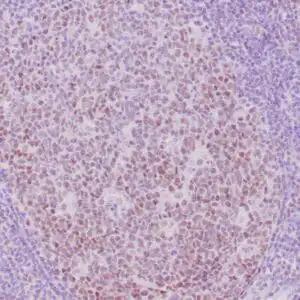 Immunohistochemistry (IHC) : Human tonsil stained with anti-retinoblastoma (Rb) antibody using peroxidase-conjugate and DAB chromogen. Note the nuclear staining of follicular center B cells.