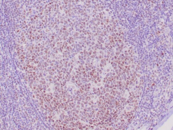 Immunohistochemistry (IHC) : Human tonsil stained with anti-retinoblastoma (Rb) antibody using peroxidase-conjugate and DAB chromogen. Note the nuclear staining of follicular center B cells.