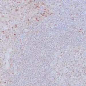 Immunohistochemistry (IHC) : Human tonsil stained with anti-retinoblastoma (Rb) antibody using peroxidase-conjugate and DAB chromogen. Note the nuclear staining of follicular center B cells.