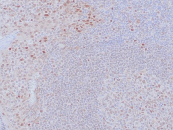 Immunohistochemistry (IHC) : Human tonsil stained with anti-retinoblastoma (Rb) antibody using peroxidase-conjugate and DAB chromogen. Note the nuclear staining of follicular center B cells.