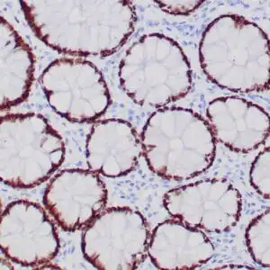Immunohistochemistry (IHC) : Formalin-fixed, paraffin-embedded human colon stained with anti-SATB2 antibody using peroxidase-conjugate and DAB chromogen. Note nuclear staining of glandular cells