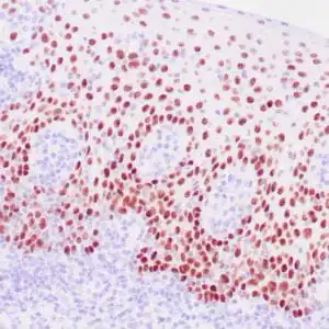 Immunohistochemistry (IHC) : Human skin stained with anti-SOX-2 antibody using peroxidase-conjugate and DAB chromogen. Note the nuclear staining of keratinocytes..