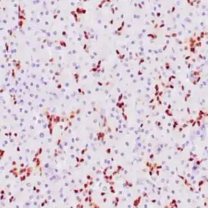 Immunohistochemistry (IHC) : Human panceas stained with anti-SOX-9 antibody using peroxidase-conjugate and DAB chromogen. Note the nuclear staining of some glandular cells.