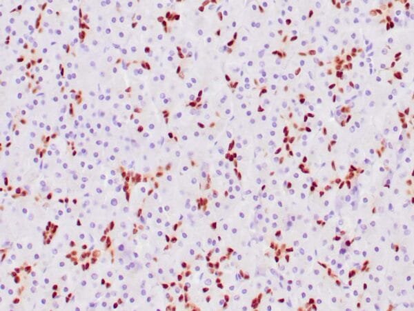 Immunohistochemistry (IHC) : Human panceas stained with anti-SOX-9 antibody using peroxidase-conjugate and DAB chromogen. Note the nuclear staining of some glandular cells.