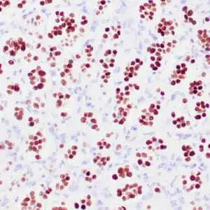 Immunohistochemistry (IHC) : Human adrenal gland stained with anti-SF-1 antibody using peroxidase-conjugate and DAB chromogen. Note nuclear staining of cortical cells.