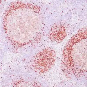 Immunohistochemistry (IHC) : Human tonsil stained with anti-TCL1 using peroxidase-conjugate and DAB chromogen. Note strong nuclear staining of perifollicular B lymphocytes.