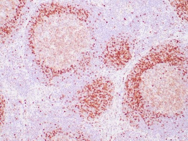 Immunohistochemistry (IHC) : Human tonsil stained with anti-TCL1 using peroxidase-conjugate and DAB chromogen. Note strong nuclear staining of perifollicular B lymphocytes.