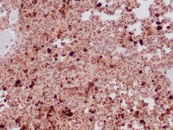 Immunohistochemistry (IHC) : Human lung infected with toxoplasma gondii stained with anti-toxoplasma gondii antibody using peroxidase-conjugate and DAB chromogen. Note positive staining of organisms..