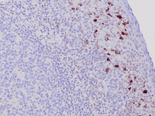 Immunohistochemistry (IHC) : Formalin-fixed, paraffin-embedded human tonsil stained with anti-TRAcP antibody using peroxidase-conjugate and DAB chromogen. Note the cytoplasmic staining of B cells