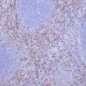 Immunohistochemistry (IHC) : Formalin-Fixed, paraffin-embedded human tonsil stained with anti-ZAP-70 antibody using peroxidase-conjugate and DAB chromogen. Note the cytoplasmic staining of B cells