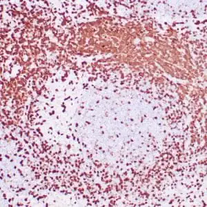 Immunohistochemistry (IHC) : Human tonsil stained with anti-ZAP-70 antibodies using  peroxidase-conjugate and DAB chromogen. Note the positive staining of perifollicular B-cells