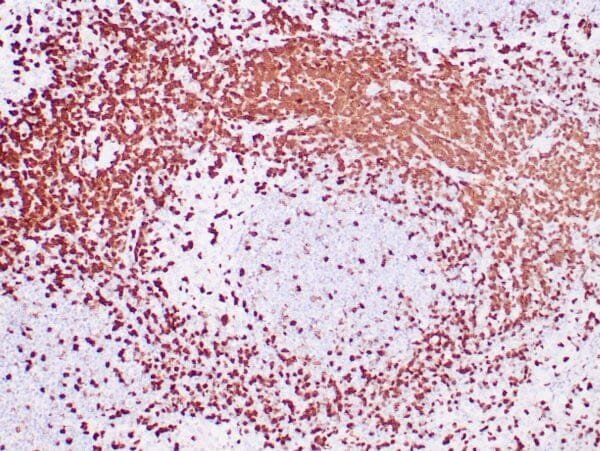 Immunohistochemistry (IHC) : Human tonsil stained with anti-ZAP-70 antibodies using  peroxidase-conjugate and DAB chromogen. Note the positive staining of perifollicular B-cells