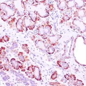 Immunohistochemistry (IHC) : Human breast tissue stained with anti-caldesmon antibody using peroxidase-conjugate and DAB chromogen. Note cytoplasmic staining of myoepithelial cells.