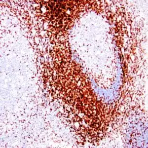 Immunohistochemistry (IHC) : Human lymph node stained with anti-CD3 antibody using peroxidase-conjugate and DAB chromogen. Note the membranous staining of perifollicular T-cells and no stain in B-cells.