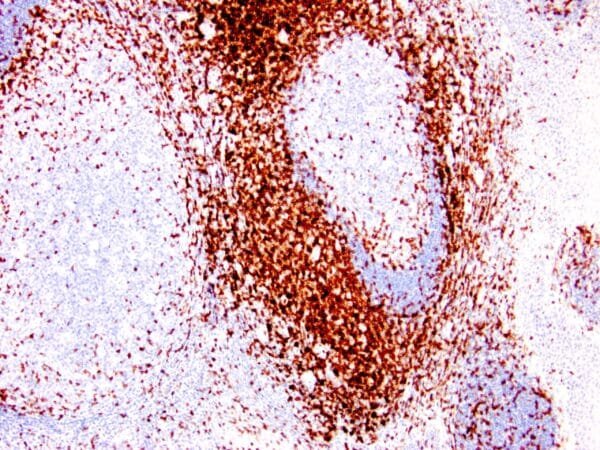 Immunohistochemistry (IHC) : Human lymph node stained with anti-CD3 antibody using peroxidase-conjugate and DAB chromogen. Note the membranous staining of perifollicular T-cells and no stain in B-cells.