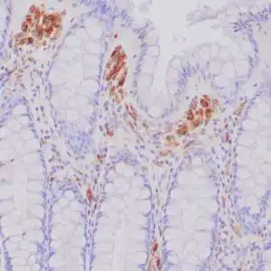 Immunohistochemistry (IHC) : Formalin-fixed, paraffin-embedded human colon stained with anti-CD68 antibody using peroxidase conjugate and DAB chromogen. Note intense cytoplasmic staining of macrophages