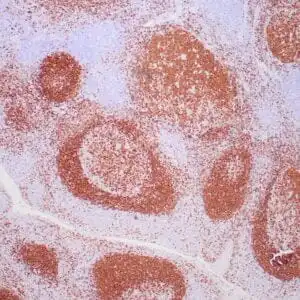 Immunohistochemistry (IHC) : Human tonsil stained with anti-PAX-5 antibody using peroxidase-conjugate and DAB chromogen. Note the nuclear staining in B cells in follicle.