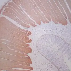 Immunohistochemistry (IHC) : Formalin-fixed, paraffin-embedded human colon stained with clone ZR169 using peroxidase-conjugate and DAB chromogen. Note strong cytoplasmic staining of muscularis propria and weak staining of muscularis mucosae.