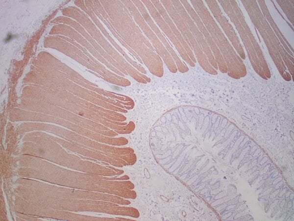 Immunohistochemistry (IHC) : Formalin-fixed, paraffin-embedded human colon stained with clone ZR169 using peroxidase-conjugate and DAB chromogen. Note strong cytoplasmic staining of muscularis propria and weak staining of muscularis mucosae.