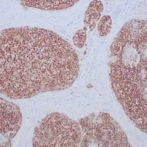Immunohistochemistry (IHC) : Human adrenal gland stained with anti-SF-1 antibody using peroxidase-conjugate and DAB chromogen. Note nuclear staining of cortical cells.
