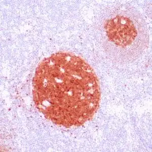 Immunohistochemistry (IHC) : Human lymph node stained with anti-BOB1 antibody using peroxidase-conjugate and DAB chromogen. Note nuclear and cytoplasmic staining of follicular center B cells .