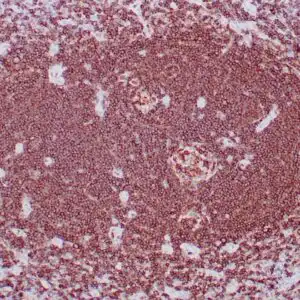 Immunohistochemistry (IHC) : Formalin-fixed, paraffin-embedded human lymph node stained with anti-CD20 antibody using peroxidase-conjugate and DAB chromogen. Note cell surface staining of B-cells.