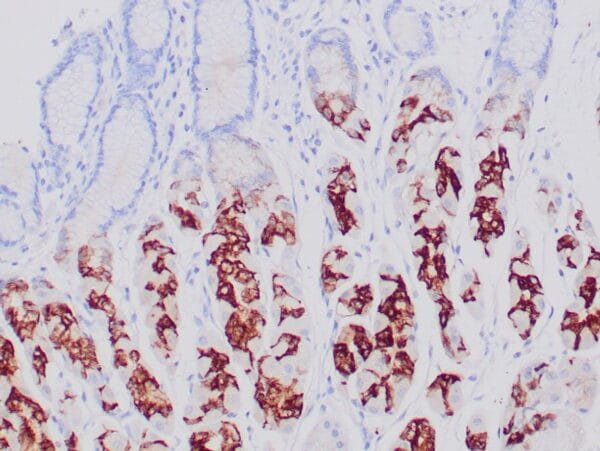 Immunohistochemistry (IHC) : Human gastric mucosa stained with anti-MUC-6 antibody using peroxidase-conjugate and DAB chromogen. Note the cytoplasmic staining of glandular cells.