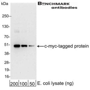 Human FSHB Protein 2548