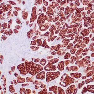 mouse anti-Cytokeratin 7 monoclonal antibody (OV-TL-12&30) 5423