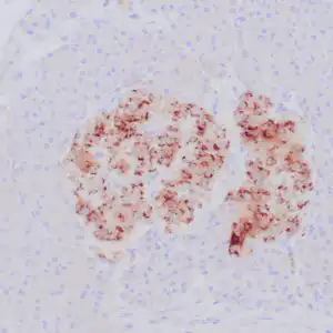 rabbit anti-Chromogranin A monoclonal antibody (ZR427) 6124