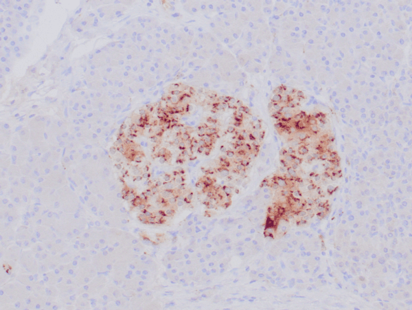 rabbit anti-Chromogranin A monoclonal antibody (ZR427) 6124