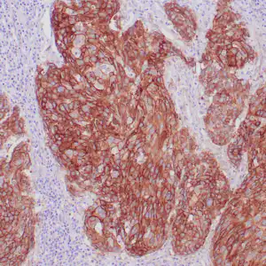 rabbit anti-EGFR monoclonal antibody (ZR16) 6167