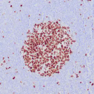 rabbit anti-Ki-67 monoclonal antibody (ZR433) 6236