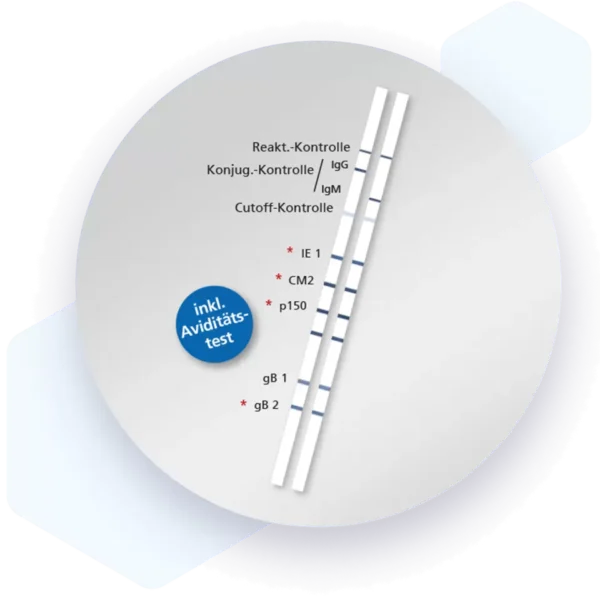 Human Cytomegalovirus IgM Lateral flow dipstick kit 5573