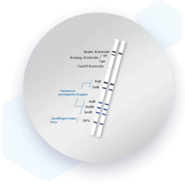 Human Hanta Virus IgM Lateral flow dipstick kit 7673